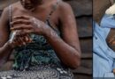Ghana Records 18 New Mpox Cases, Total Hits 346